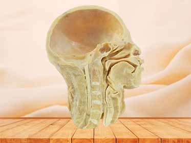 human pharynx plastination