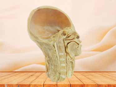medical pharynx plastinated specimen