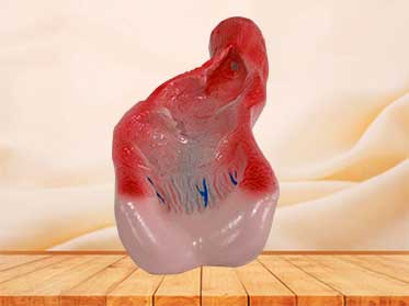 rectum cavity model