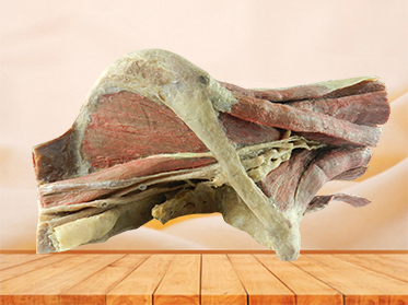 sagittal section of female pelvis with uterus vessels