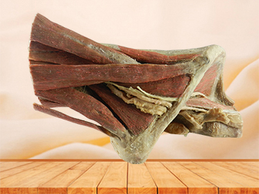 sagittal section of female pelvis with uterus vessels plastinated specimen