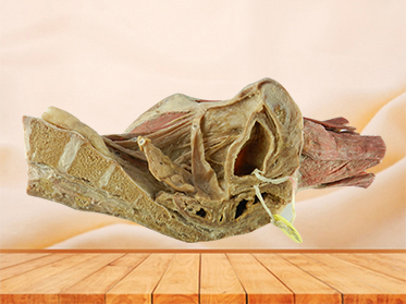sagittal section of female pelvis with uterus vessels specimen