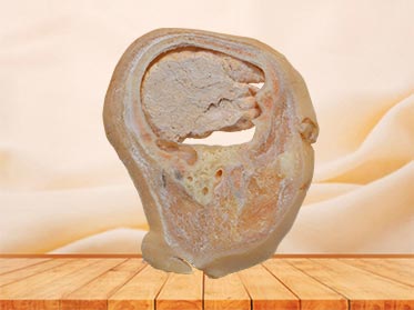 sagittal section of head