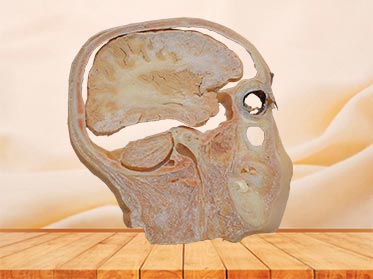 sagittal section of head plastination