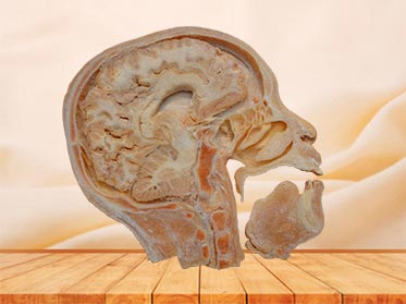 sagittal section of head specimen