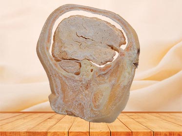 sagittal section of head specimen plastination