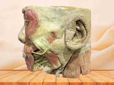 salivary gland plastinated specimen