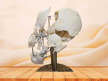 separated skull teaching plastinated specimen