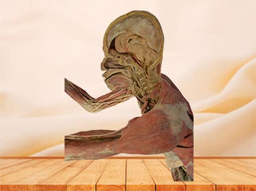 shooting specimen(median sagittal section of head)