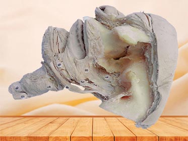 Side view of pharyngeal muscle plastinated specimen