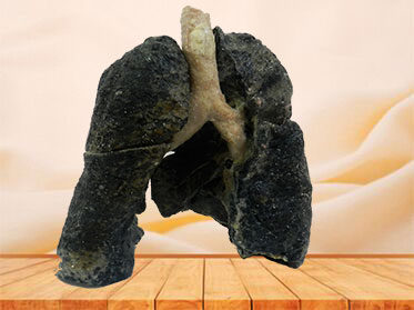 smoker lung