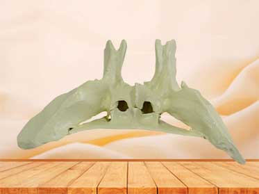 sphenoid bone