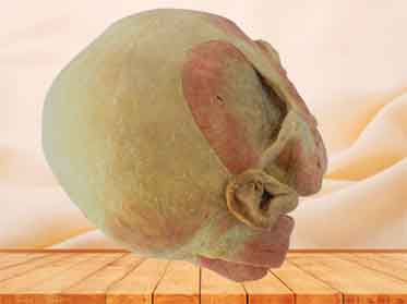 masticatory superficial muscle