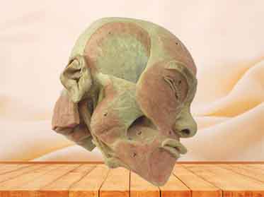 superficial muscle of masticatory plastinated specimen