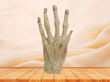 superficial palmar arch