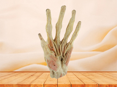 superficial palmar arch for teaching
