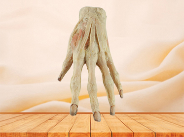 superficial palmar arch medical specimen