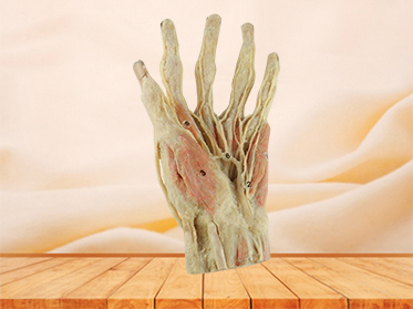 superficial palmar arch plastination