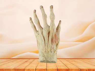 superficial palmar arch plastination specimen