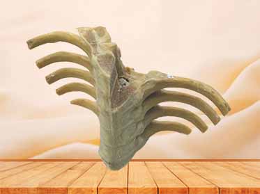 vertebral column section plastinatedspecimen