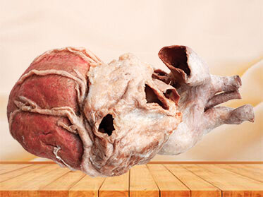 whole heart plastination specimen