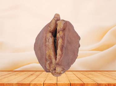 Breast Cancer Model