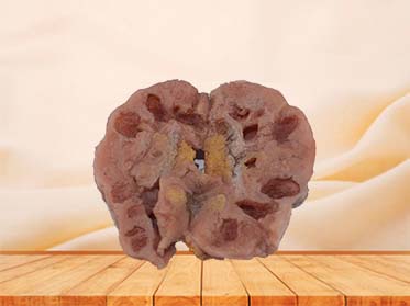 Cavernous Renal Tuberculosis Model