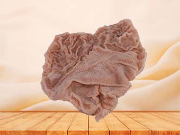 Duodenal Ulcer Anatomy Model