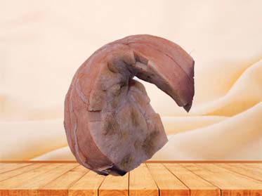 Hepatic Vascular Endothelial Cell Sarcoma Anatomy Model