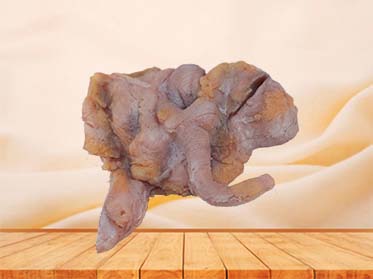 Ileocecal Adenocarcinoma Model