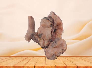 Malignant Pleural Mesothelioma Anatomy Model