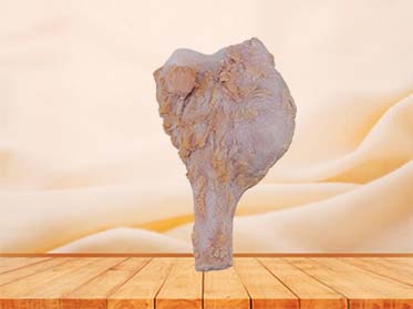 Osteosarcoma Silicone Anatomy Model