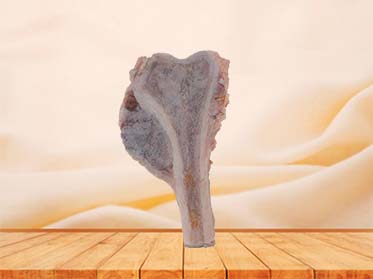 Osteosarcoma Silicone Model