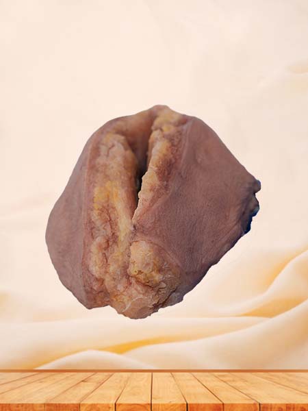Soft Simulated Silicone Breast Cancer Model