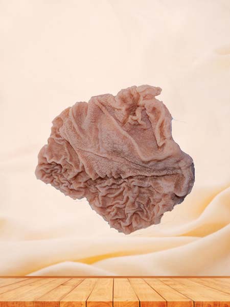 Soft Simulated Pathology Duodenal Ulcer Silicone Model