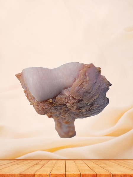 Soft Simulated Osteosarcoma Pathology Model
