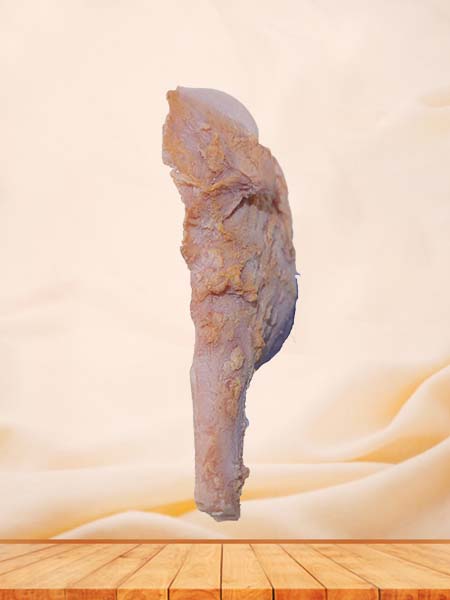 Soft Simulated Osteosarcoma Pathology Model