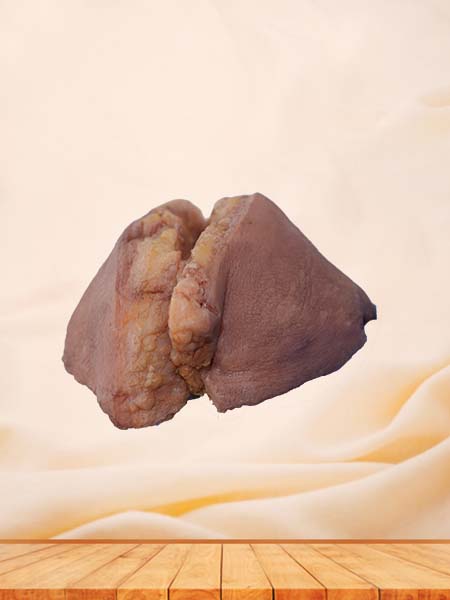 Soft Simulated Silicone Breast Cancer Model