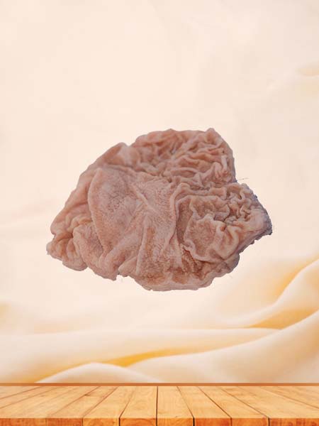 Soft Simulated Pathology Duodenal Ulcer Silicone Model