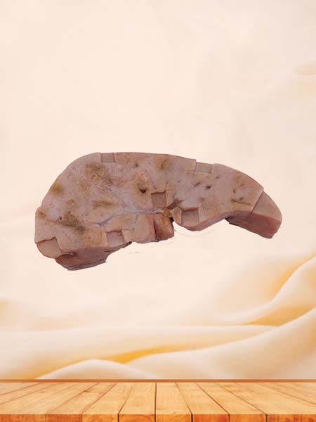 Soft Simulated Hepatic Vascular Endothelial Cell Sarcoma Silicone Model