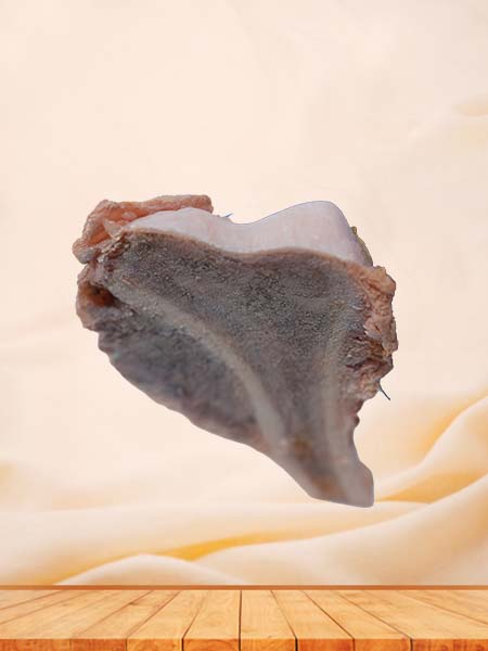 Soft Simulated Osteosarcoma Pathology Model