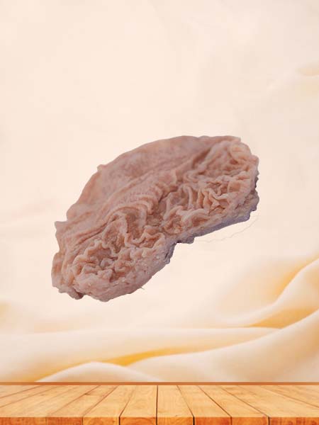 Soft Simulated Pathology Duodenal Ulcer Silicone Model
