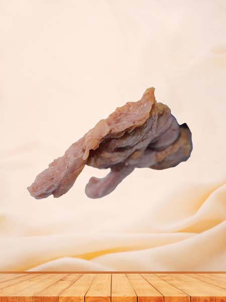 Soft Simulated Ileocecal Adenocarcinoma Pathology Model
