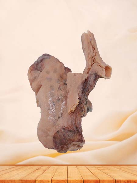 Soft Simulated Malignant Pleural Mesothelioma Pathology Specimen