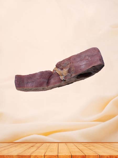 High Simulation Bile Duct Epithelial Liver Cancer Pathology Specimen