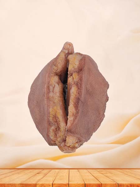 Soft Simulated Silicone Breast Cancer Model