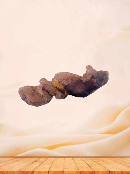 Soft Simulated Human Cavernous Renal Tuberculosis Pathology Model
