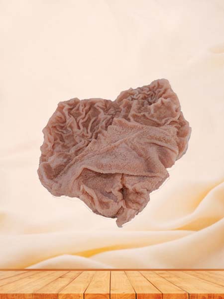 Soft Simulated Pathology Duodenal Ulcer Silicone Model