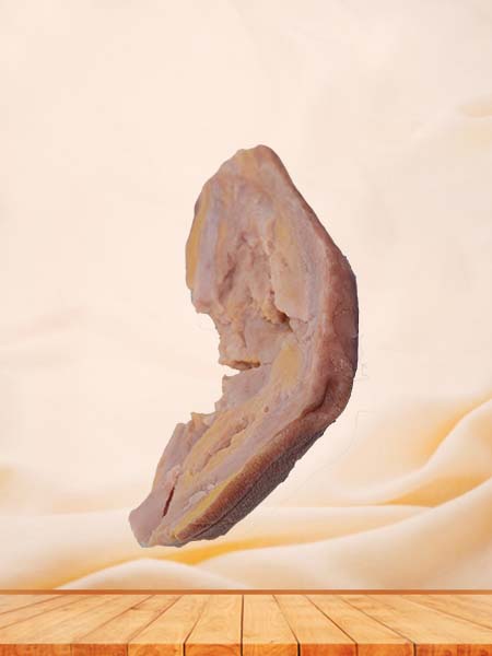 Soft Simulated Hodgkin's Disease Pathology Model