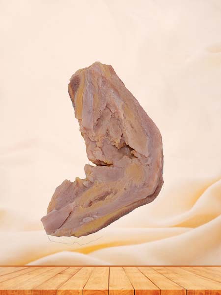 Soft Simulated Hodgkin's Disease Pathology Model